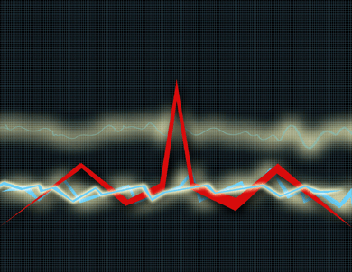Chart showing heart spiking with red line